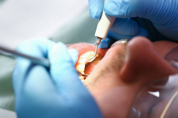 Best Emergency Dental Care for Broken or Chipped Teeth in Crestview Hills, KY